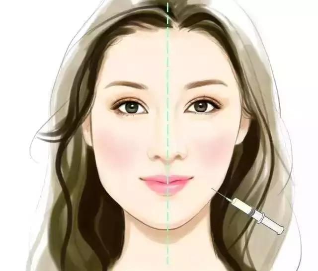 郑州瘦脸针维持时间,瘦脸针后咬肌变化图