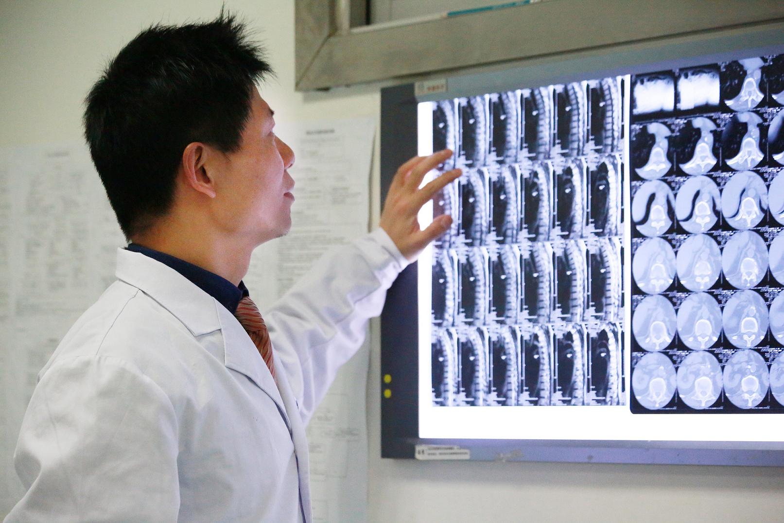 神经根型颈椎病是骨刺压迫神经吗,颈椎长骨刺严重吗怎么治