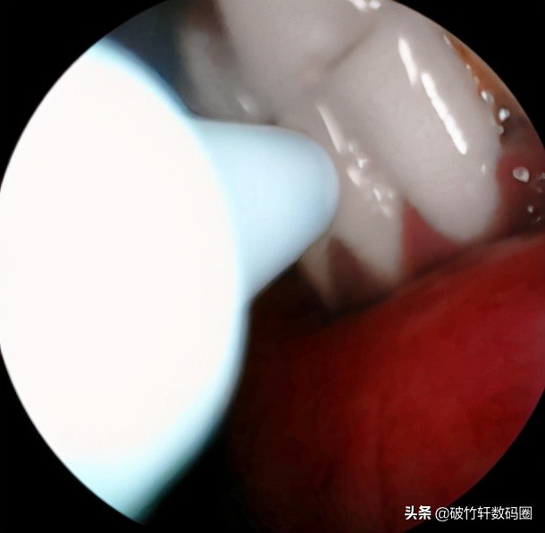 自带瞄准器洗牙小工具，每分强输出1600次，激起*男猛**电竞梦