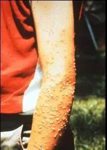 筑牢国门生物安全防线,国门生物安全当好国门卫士