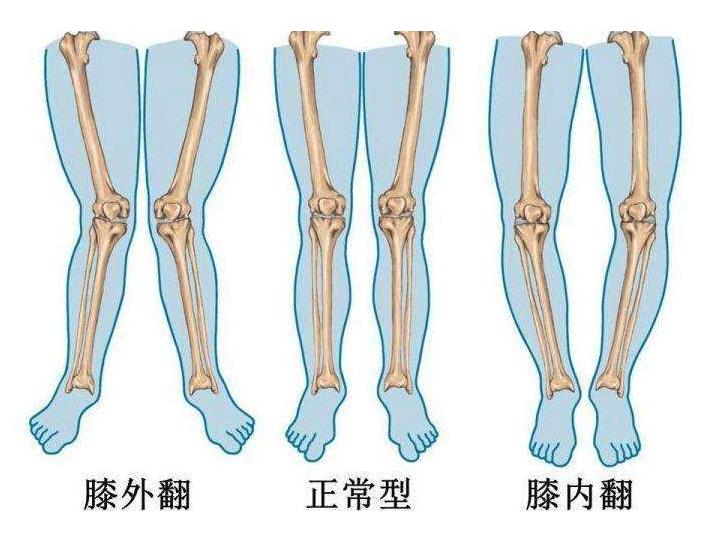无器械腿部训练方法,器械锻炼腿的器材