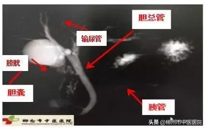 磁共振检查对身体有害吗,医院磁共振是检查什么的