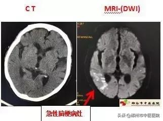 磁共振检查对身体有害吗,医院磁共振是检查什么的