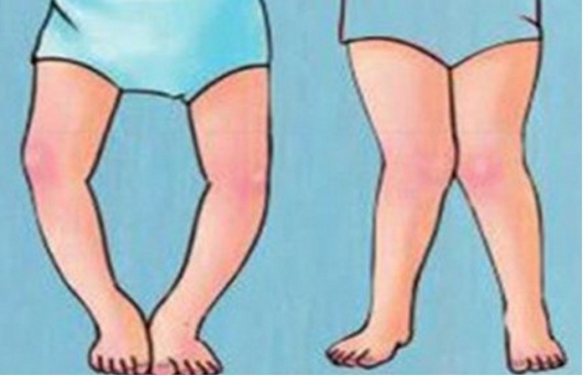 幼儿补充维生素d指南,婴幼儿补充维生素d指南