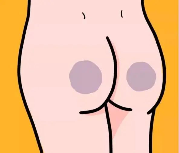 屁股坐久两边长期发黑怎么去,长期坐凳子屁股发黑抹什么药