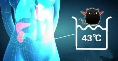 渭南市第二医院应用腹腔热灌注化疗技术为肿瘤患者健康保驾护航