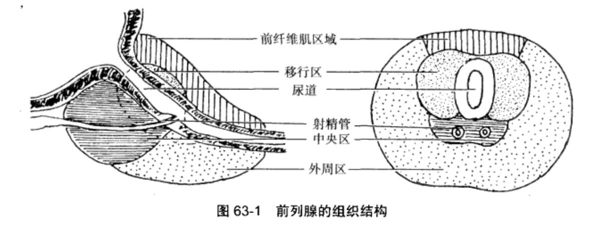 良性前列腺增生最早出现的症状是,彩超提示前列腺增生是前列腺癌吗