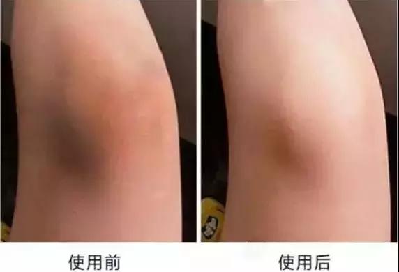 用了身体乳皮肤变好,用了身体乳皮肤特别嫩