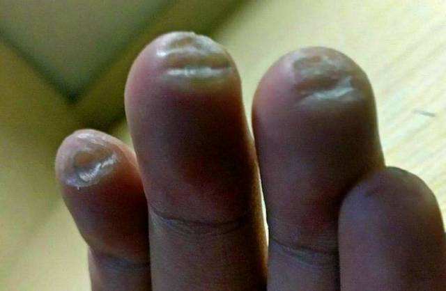 新手弹吉他为什么会痛,新手弹吉他手好痛