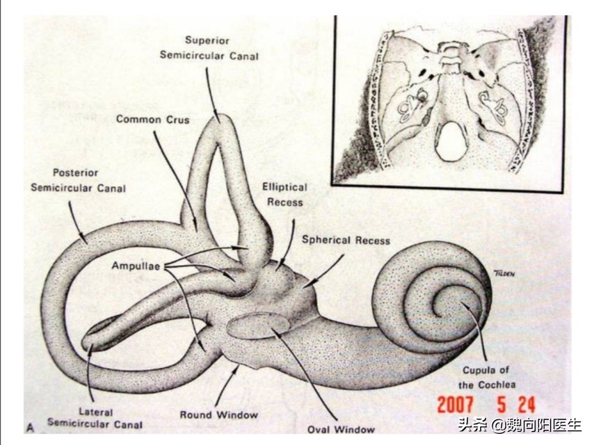 耳石症复位后还是眩晕需要输液吗,耳石症头晕输液能治疗吗