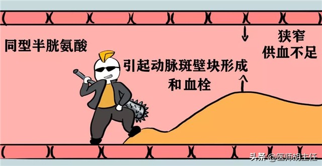 80岁老人同型半胱氨酸高怎么办,同型半胱氨酸高的原因中老年人