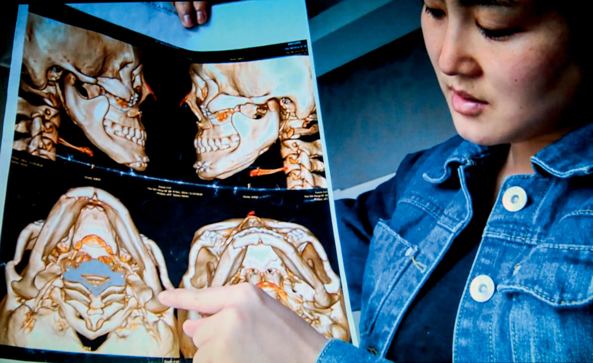 整形到底是失败还是毁容,美容变毁容完整版