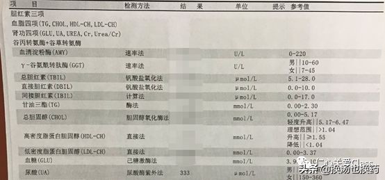 尿酸高治疗用药指南,尿酸高减肥饮食指南