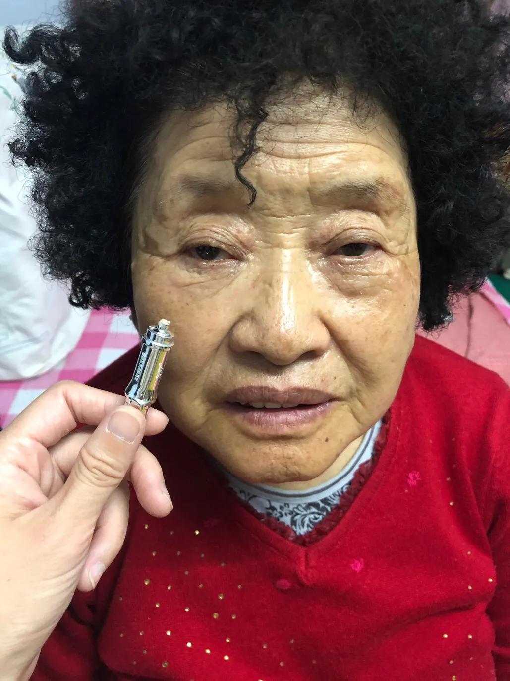 s37微雕眼好用吗,s37微雕眼部套