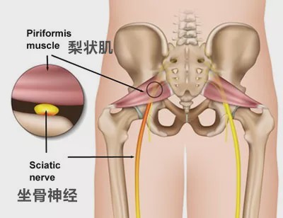 腰椎间盘轻度膨出症状有哪些,同样是腰椎膨出为啥有人无症状