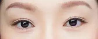 把水光针当饭吃？这位网红简直丧心病狂！整容后年入千万