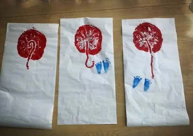 谢依霖生完二胎变美了,谢依霖宣布二胎视频