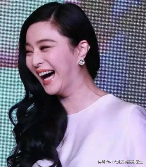 下巴脂肪堆积的解决方法,下巴脂肪过多怎么办