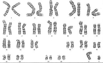 育有一孩的爸爸却被告知为“无精子症”，难道……