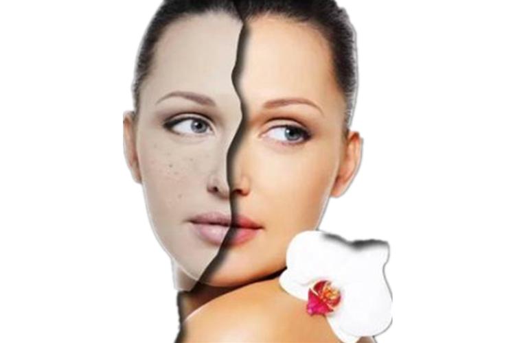 脸上有斑用什么护肤品祛斑效果好,40岁女人脸上长斑怎样有效祛斑