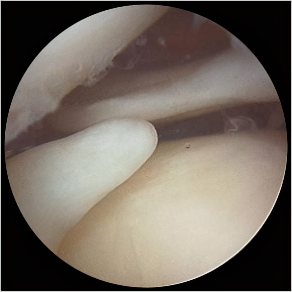 膝盖一直痛是什么病,膝盖一直受伤代表什么