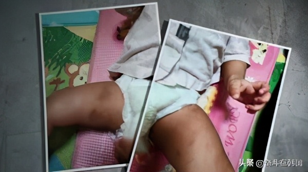 男童被虐待肝破裂,韩国小孩被家暴内脏破裂