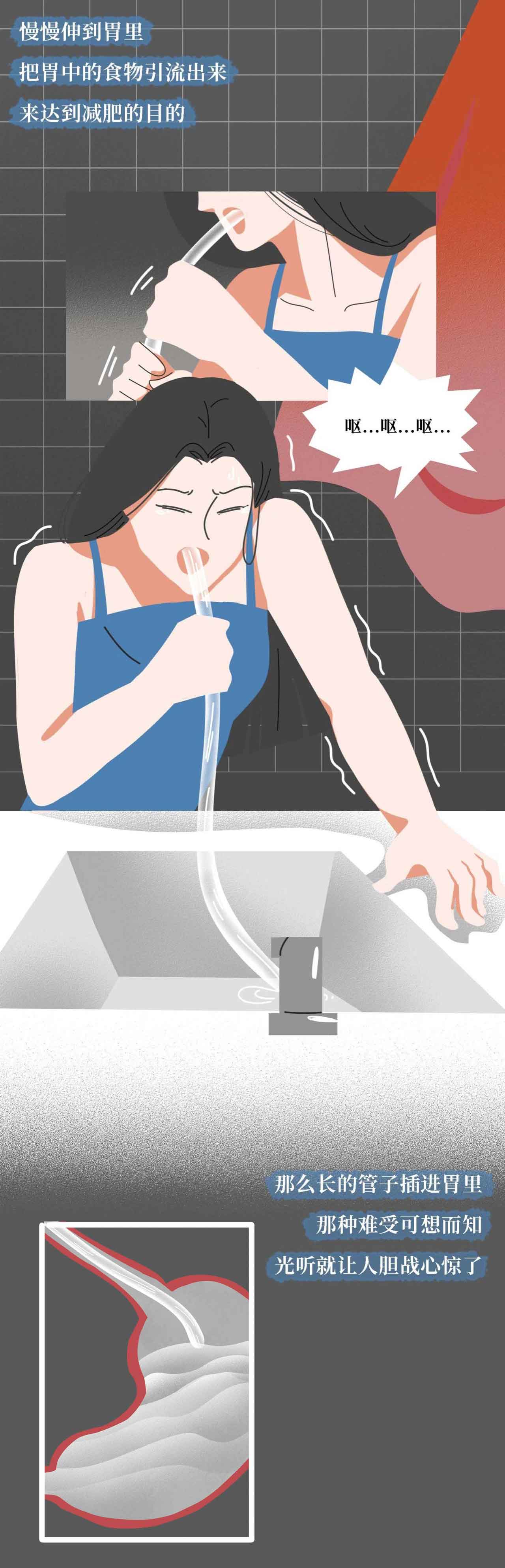 催吐,外挂般的减肥方式?吃的是欲望,吐的是灵魂