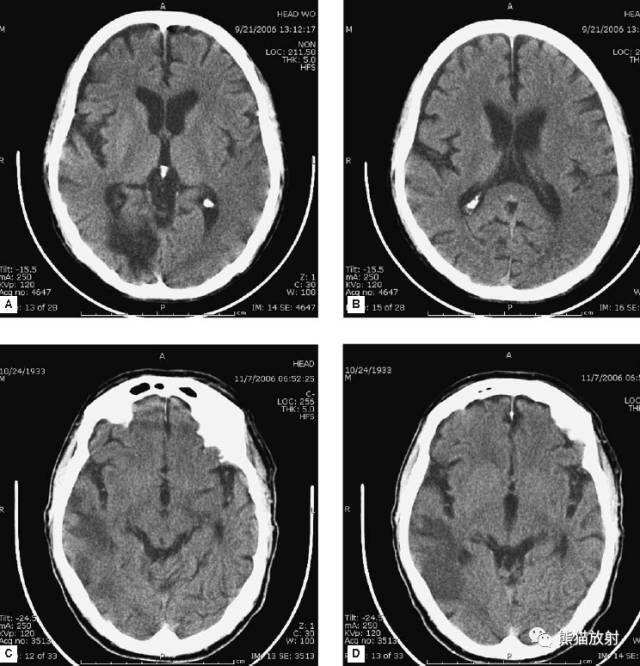 值夜班需要注意什么身体健康,值夜班的十大危害