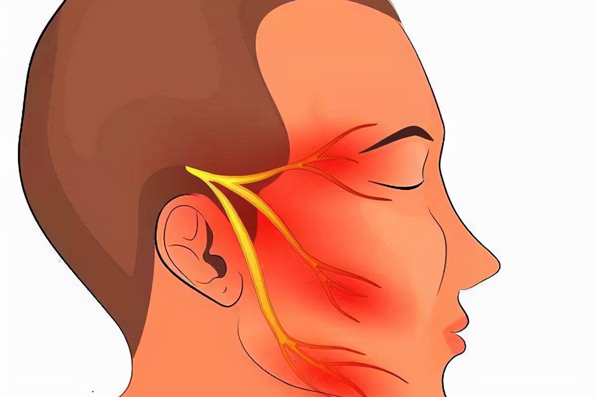 怎么分清是牙痛还是三叉神经痛,三叉神经痛和牙痛的区别是什么