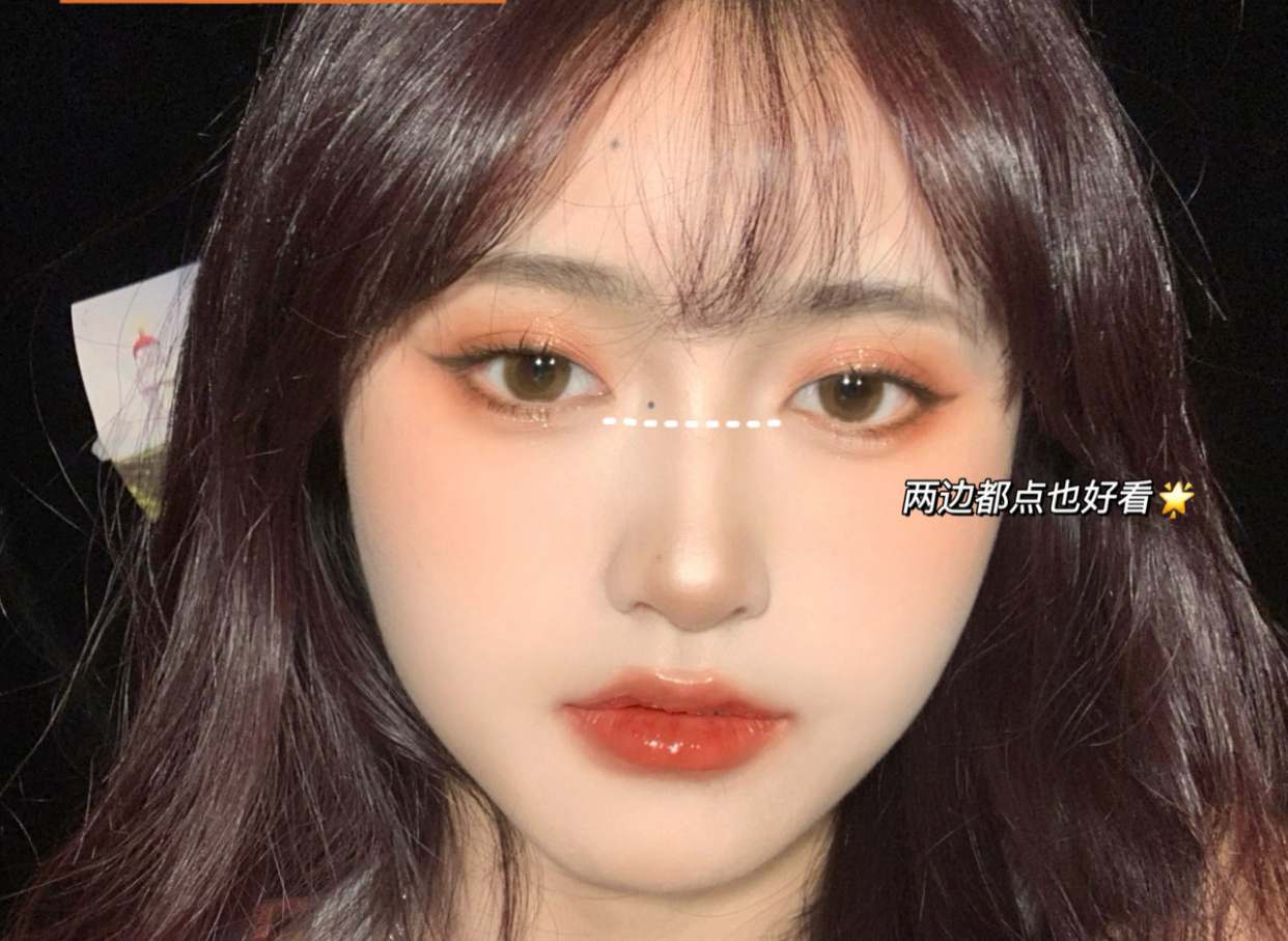 脸上哪个位置化妆化痣好看,脸上哪种点痣方法最好