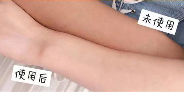 冬天皮肤干燥起皮屑用什么护肤品,一到冬天脸部干燥起皮补什么