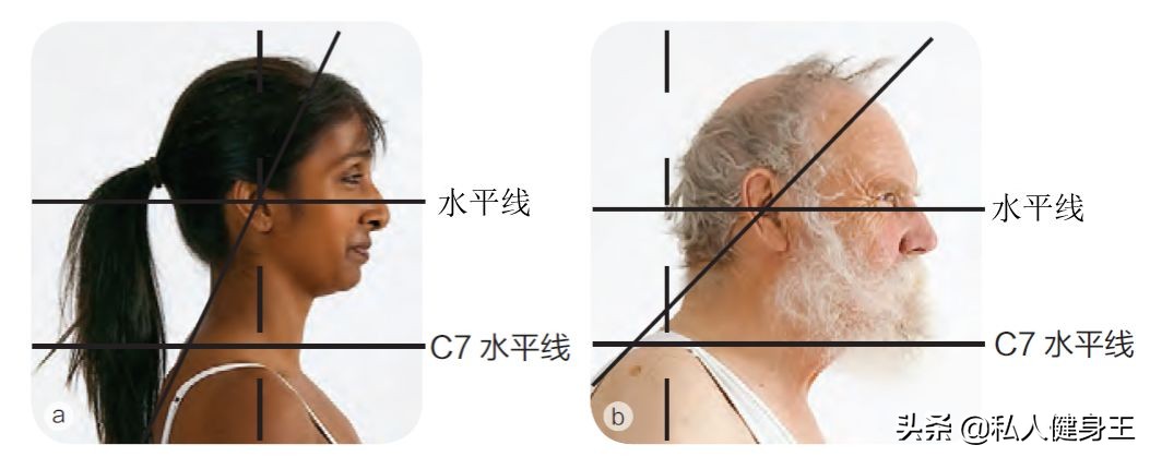 改善头前伸肩膀内扣,一招改善头前伸