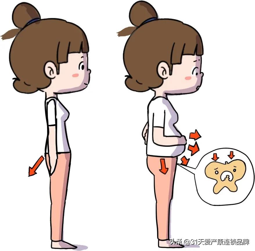 盆底肌不松女人不老,女人盆底不松怎么办