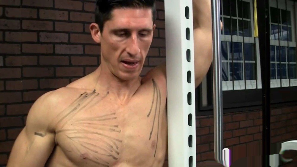 上交叉综合征肌肉失衡分析,上交叉体态综合症