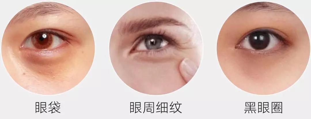 去黑眼圈细纹的全能眼霜排行,淡化细纹黑眼圈推荐哪款眼霜