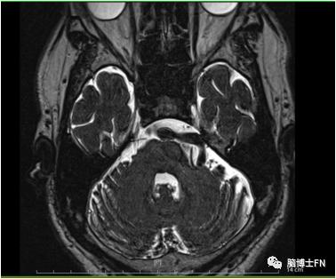 天下第一痛到底有多痛,天下第一痛是怎样的