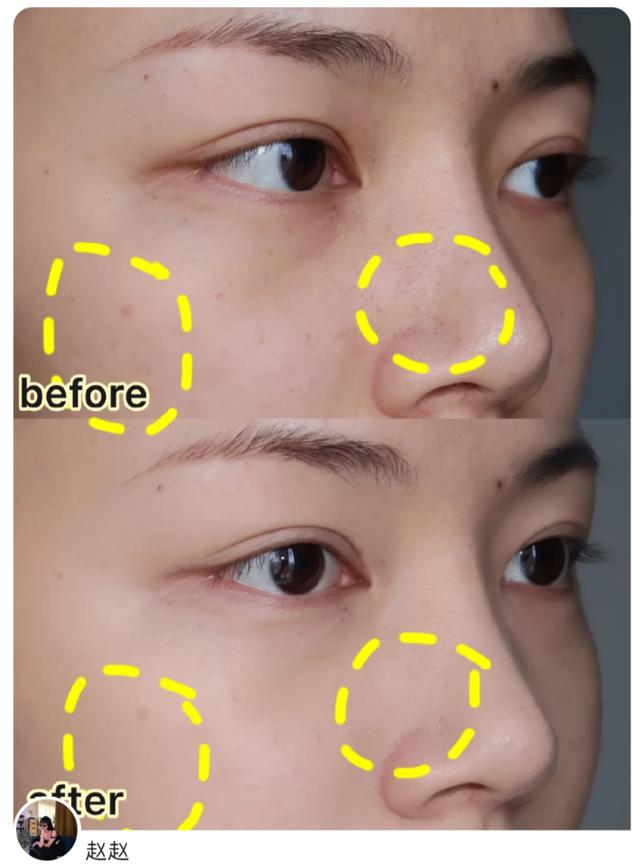 黛珂cpb护肤品推荐,黛珂cpb哪个更高级