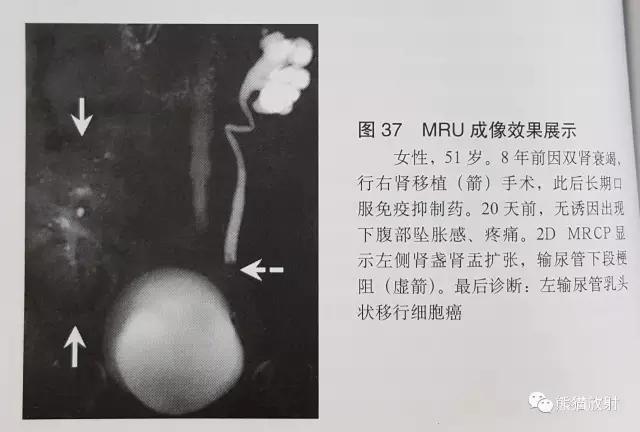 磁共振泌尿系水成像检查注意事项,磁共振影像基础知识讲解