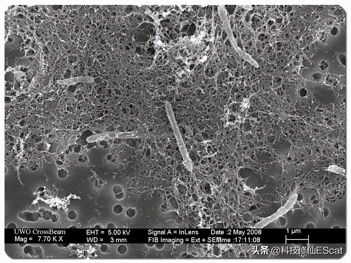 食用菠菜对人体有好处吗,吃菠菜可以预防什么疾病