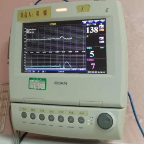 妇产医生扭转胎位,中医胎位倒转术