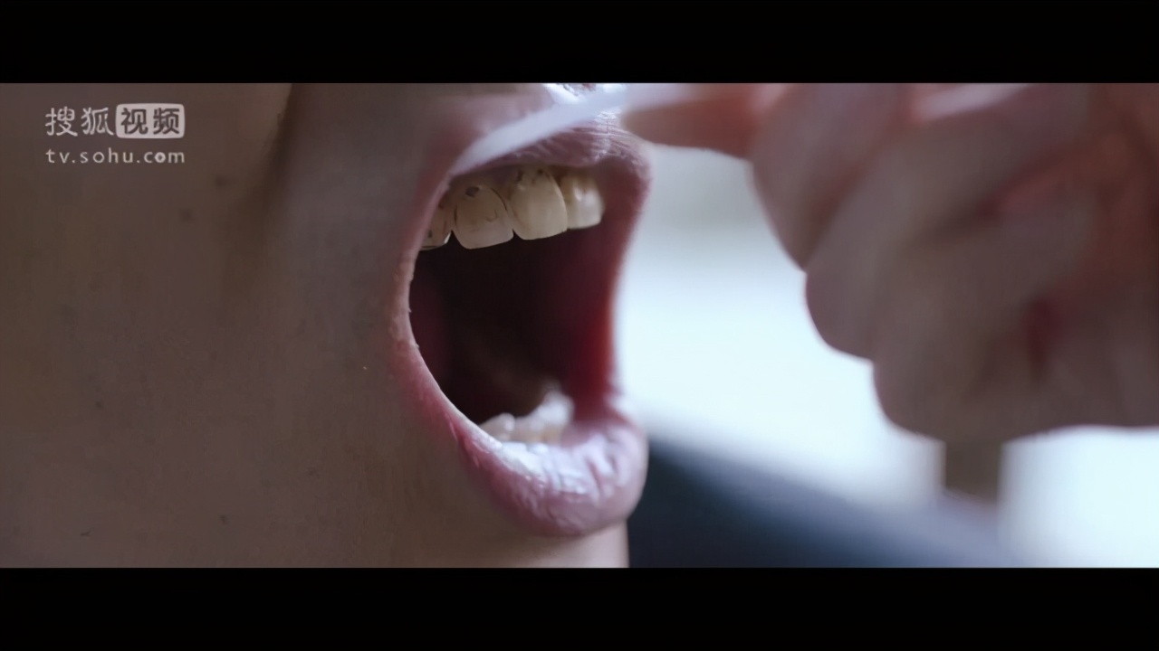 我的笑容就像一个空洞！”22岁女子吸毒6年，瘦到脸凹牙拔光…