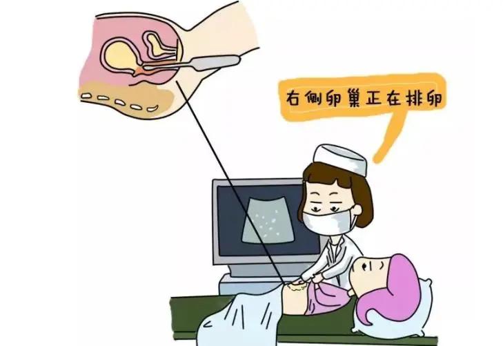 备孕科普素材,卵泡长大了不排会引起雌二醇低吗