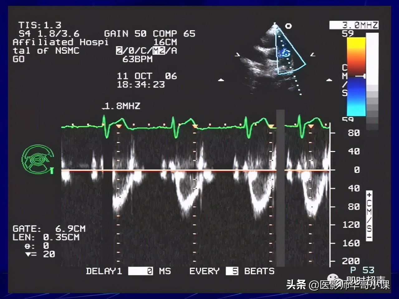 超声检查报告单讲解,超声图像检查