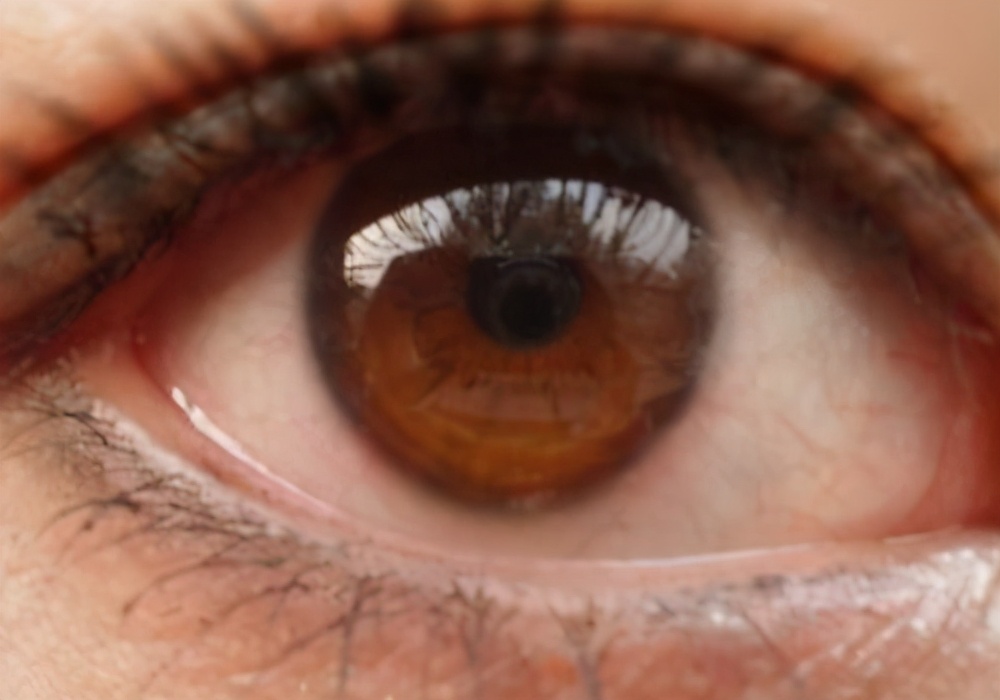 干纹细纹和皱纹统称什么,内眼角细纹是皱纹还是干纹