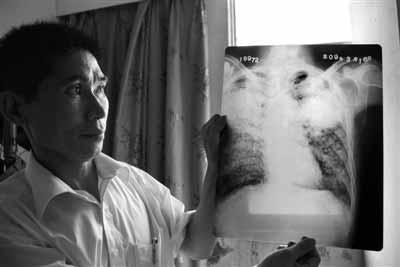 农民工患尘肺病国家有什么政策,农民工尘肺解决方案