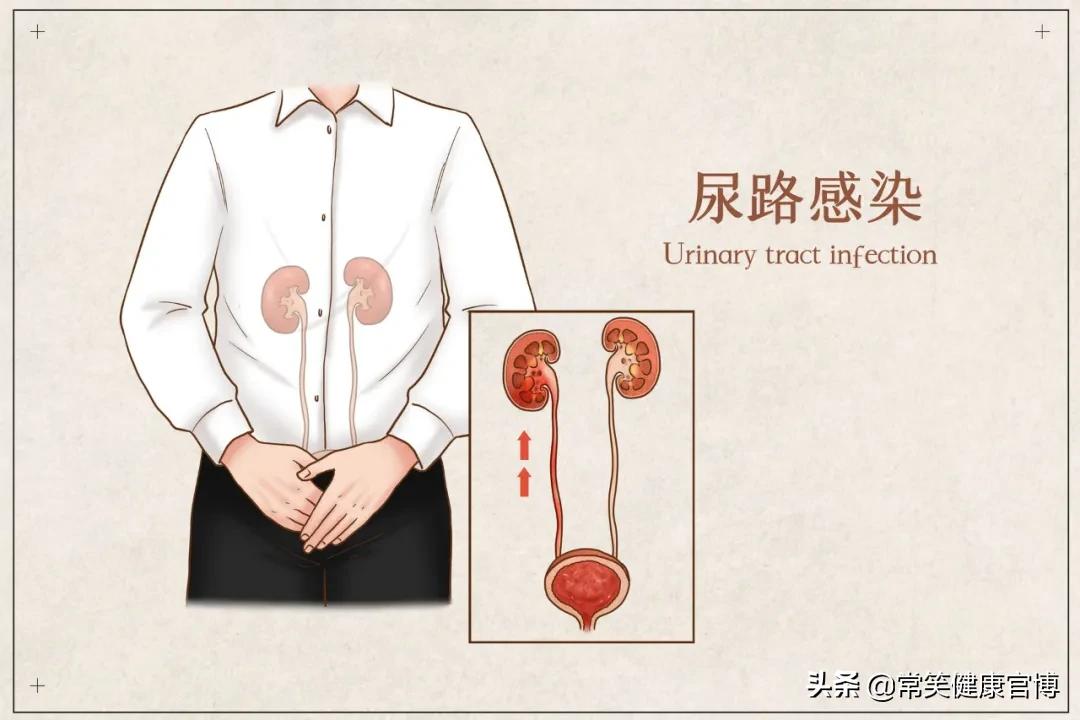 尿路感染最常见的原因是,发生医院内尿路感染最常见的原因