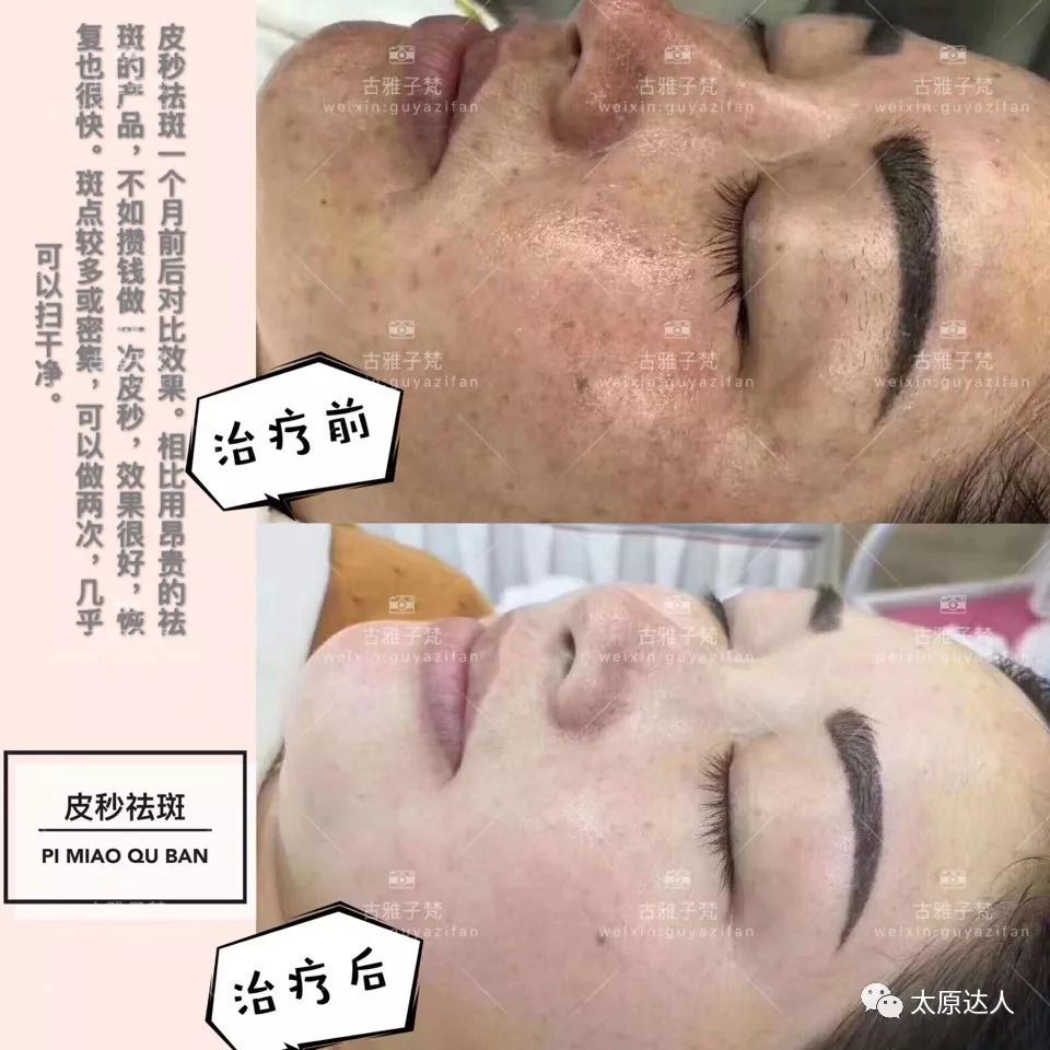 814元人气精华护理免费做！一次就焕颜新生！聚会女王就是你