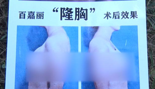 沈阳百嘉丽整形可靠吗,沈阳百嘉丽医院靠谱吗