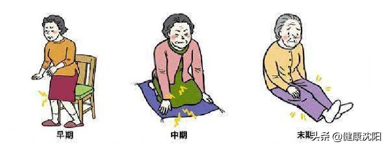 健康科普堂|【视频】“爱膝”就是爱自己