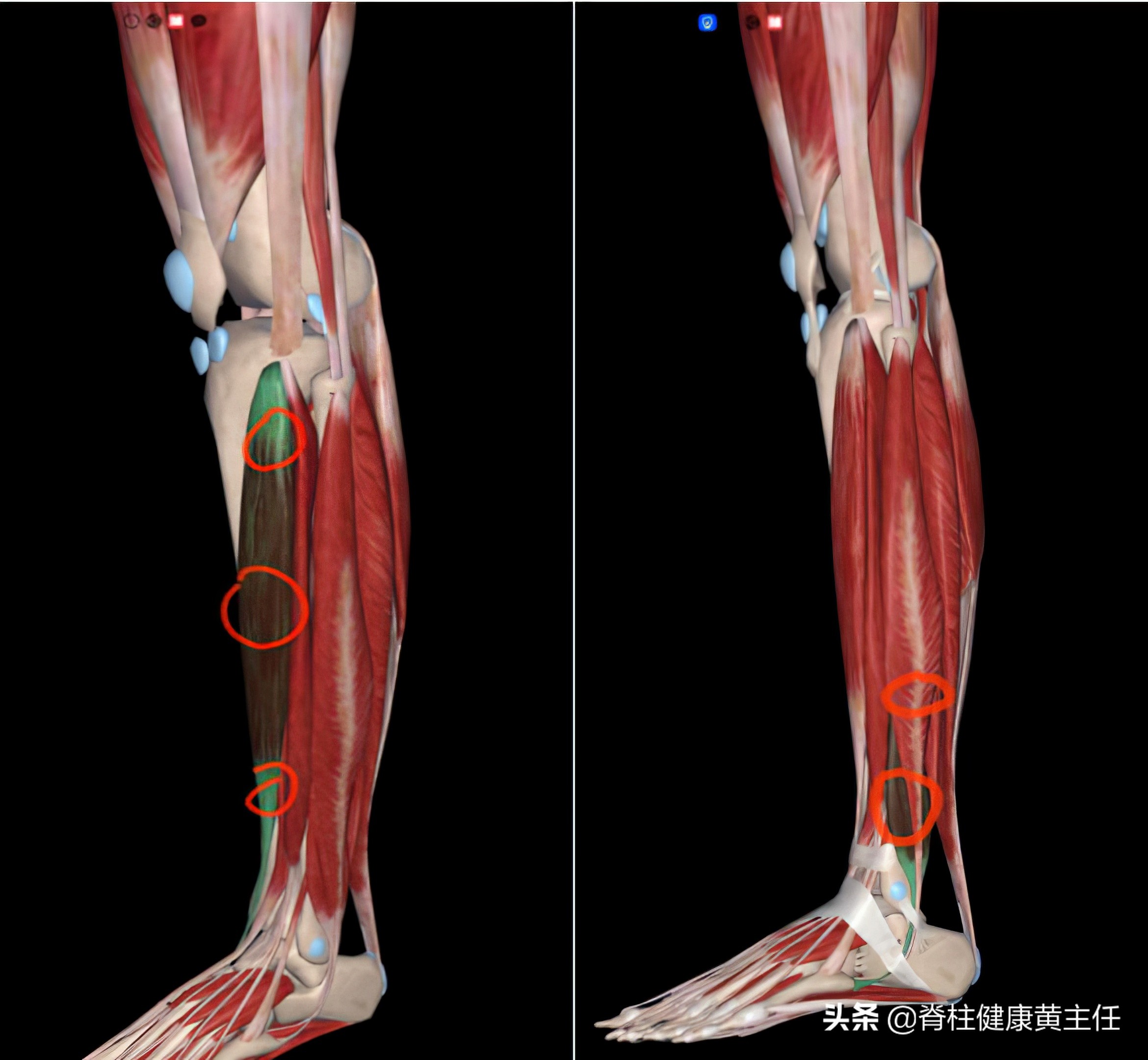 踝关节扭伤脱位手法复位视频,踝关节扭伤手法复位多久可以运动